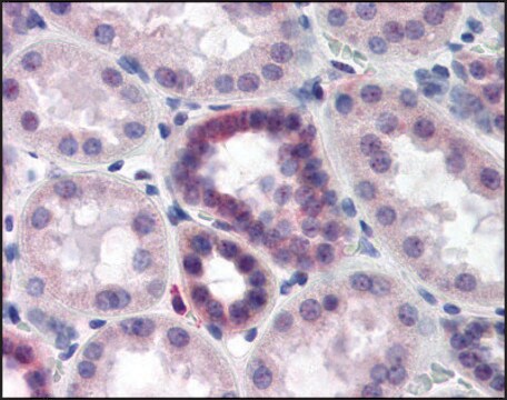 Anti-CAND2 antibody produced in rabbit whole antiserum