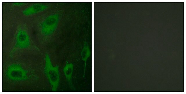 Anti-Aquaporin 2 antibody produced in rabbit affinity isolated antibody