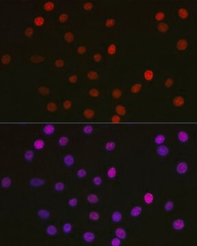 Anti- Acetyl-HMGB1-K29 antibody produced in rabbit