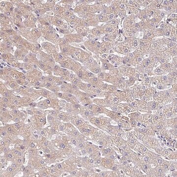 抗-TTR 兔抗 Prestige Antibodies&#174; Powered by Atlas Antibodies, affinity isolated antibody, buffered aqueous glycerol solution