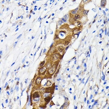 Anti- NF-kB p65/RelA antibody produced in rabbit