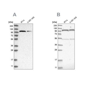 抗OGT ウサギ宿主抗体 Prestige Antibodies&#174; Powered by Atlas Antibodies, affinity isolated antibody, buffered aqueous glycerol solution, ab1