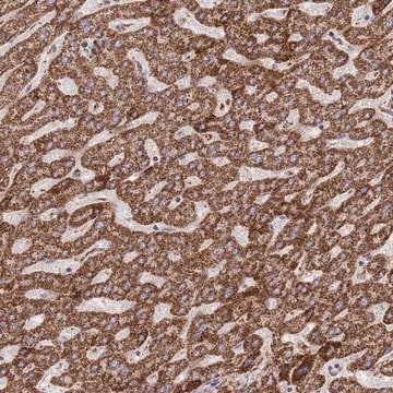 Anti-GSTM1 antibody produced in rabbit Prestige Antibodies&#174; Powered by Atlas Antibodies, affinity isolated antibody, buffered aqueous glycerol solution