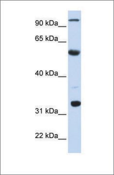 Anti-APOBEC1 antibody produced in rabbit affinity isolated antibody