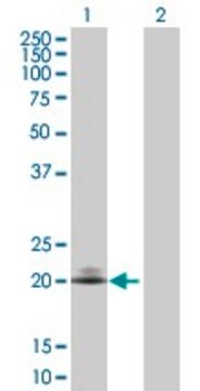 Anti-CD160 antibody produced in rabbit purified immunoglobulin, buffered aqueous solution