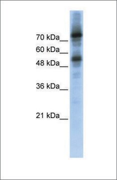 Anti-FOXM1 (ab2) antibody produced in rabbit affinity isolated antibody