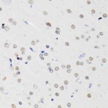 Anti-Acetyl-Histone H4-K5 antibody produced in rabbit