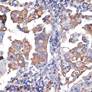 Anti-VPS11 antibody produced in rabbit