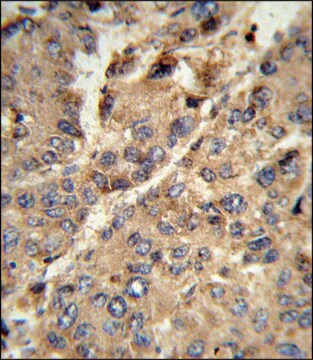 ANTI-XDH (N-TERM) antibody produced in rabbit IgG fraction of antiserum, buffered aqueous solution