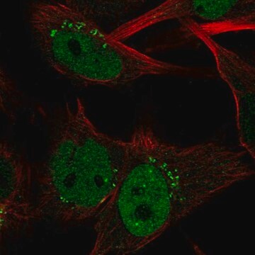 Anti-CLSPN Prestige Antibodies&#174; Powered by Atlas Antibodies, affinity isolated antibody