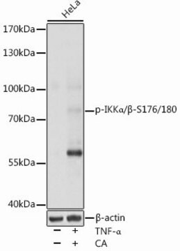 Anti-Phospho-IKK&#945;/&#946;-S176/180 antibody produced in rabbit