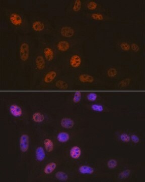 Anti- SMARCB1/SNF5 antibody produced in rabbit