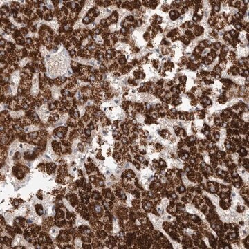 抗RNF217抗体 ウサギ宿主抗体 Prestige Antibodies&#174; Powered by Atlas Antibodies, affinity isolated antibody, buffered aqueous glycerol solution