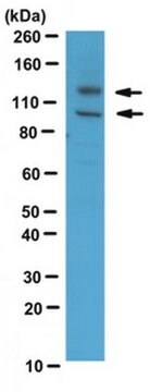 Anti-Adam17 Antibody serum, from rabbit