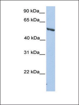 Anti-IMPDH2 antibody produced in rabbit affinity isolated antibody