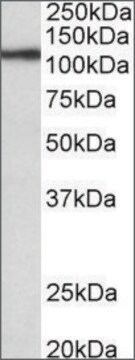 抗TPO抗体 ヤギ宿主抗体 affinity isolated antibody, buffered aqueous solution