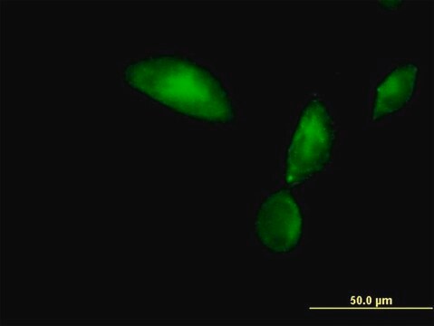 Anti-TMOD3 antibody produced in mouse purified immunoglobulin, buffered aqueous solution