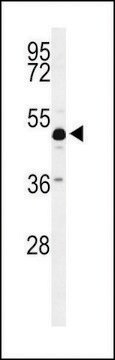 ANTI-ANKH(C-TERMINAL) antibody produced in rabbit affinity isolated antibody, buffered aqueous solution