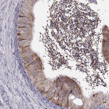 Anti-ROPN1B antibody produced in rabbit Prestige Antibodies&#174; Powered by Atlas Antibodies, affinity isolated antibody, buffered aqueous glycerol solution