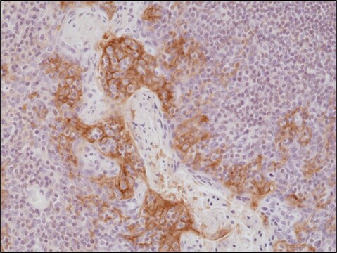 Anti-PD-L1antibody, Rabbit Monoclonal recombinant, expressed in HEK 293 cells, clone RM320, purified immunoglobulin