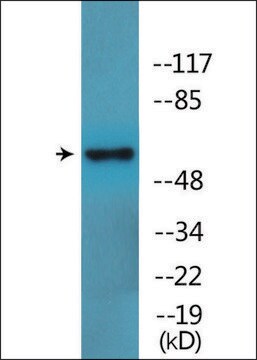 Anti-phospho-LCK (pSer59) antibody produced in rabbit affinity isolated antibody