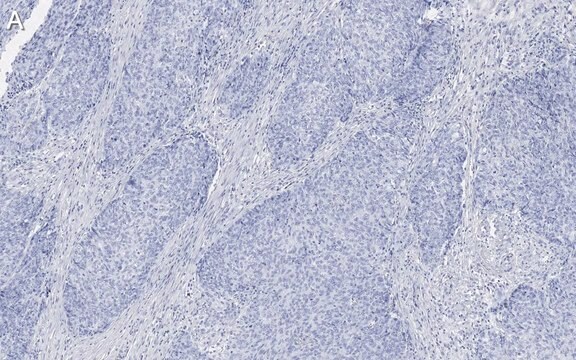 Anti-Integrin &#946;1 Antibody, clone 1A27 , ZooMAb&#174; Rabbit Monoclonal recombinant, expressed in HEK 293 cells