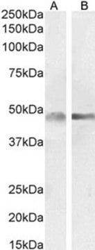 Anti-GFAP antibody produced in goat affinity isolated antibody, buffered aqueous solution