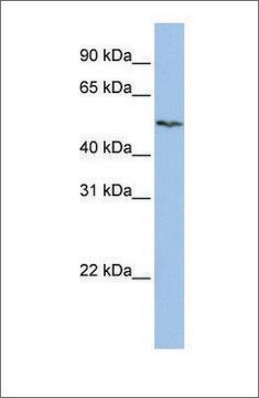 Anti-SLC16A6 antibody produced in rabbit affinity isolated antibody