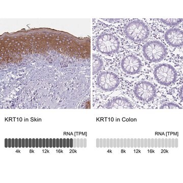 Anti-KRT10 antibody produced in rabbit Prestige Antibodies&#174; Powered by Atlas Antibodies, affinity isolated antibody, buffered aqueous glycerol solution