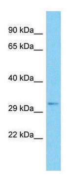 Anti-SRRM2 (C-terminal) antibody produced in rabbit affinity isolated antibody