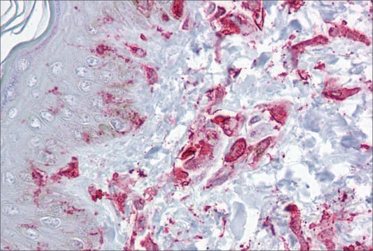 Anti-ZFP36L2 antibody produced in rabbit affinity isolated antibody