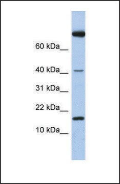 Anti-IL4 antibody produced in rabbit affinity isolated antibody