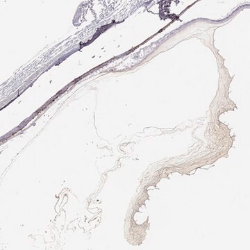 Anti-COL9A3 antibody produced in rabbit Prestige Antibodies&#174; Powered by Atlas Antibodies, affinity isolated antibody, buffered aqueous glycerol solution