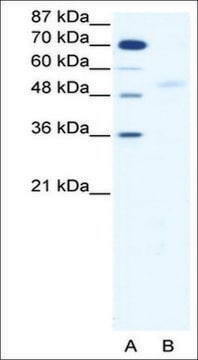 Anti-SMAD5 antibody produced in rabbit affinity isolated antibody