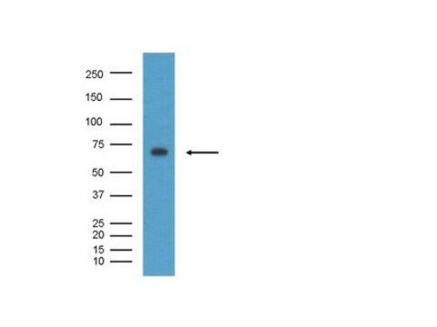 Anti-BACE-Antikörper, CT, Klon 61-3E7 clone 61-3E7, Chemicon&#174;, from mouse