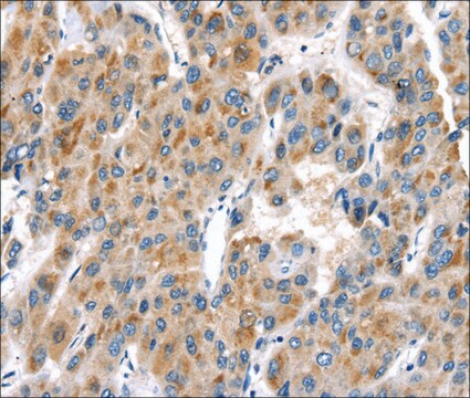 Anti-UCP2 affinity isolated antibody