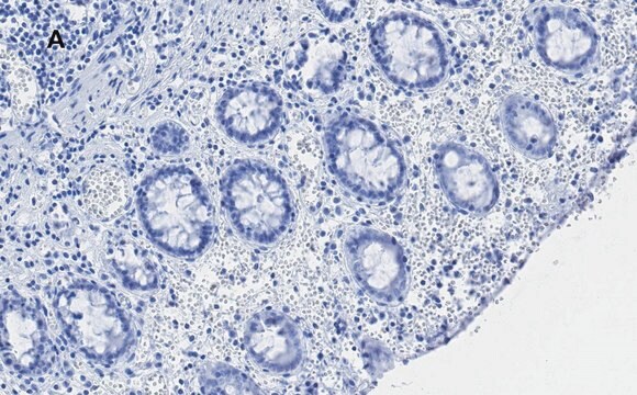 抗C-EBP &#946;抗体 クローン8G18 ZooMAb&#174; ウサギ・モノクローナル recombinant, expressed in HEK 293 cells