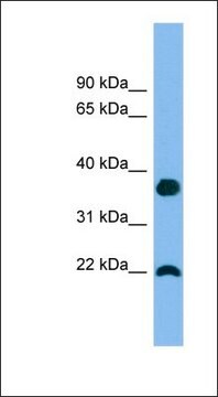 Anti-WFDC1 antibody produced in rabbit affinity isolated antibody