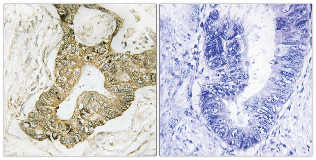 Anti-p90 RSK antibody produced in rabbit affinity isolated antibody