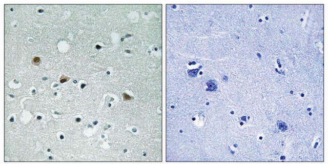 Anti-phospho-LATS1/2(pThr1079/1041) affinity isolated antibody