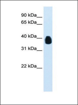 Anti-ETV7 antibody produced in rabbit affinity isolated antibody