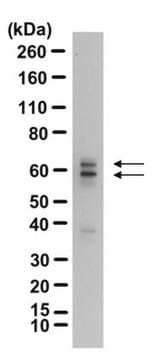 Anti-GAD65 Antibody from rabbit, purified by affinity chromatography