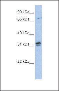 Anti-H1FOO, (N-terminal) antibody produced in rabbit affinity isolated antibody