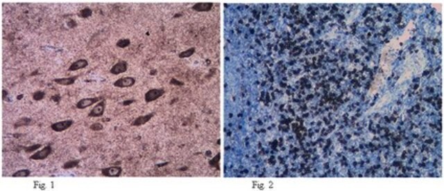 Anti-VPAC2 Antibody from rabbit, purified by affinity chromatography