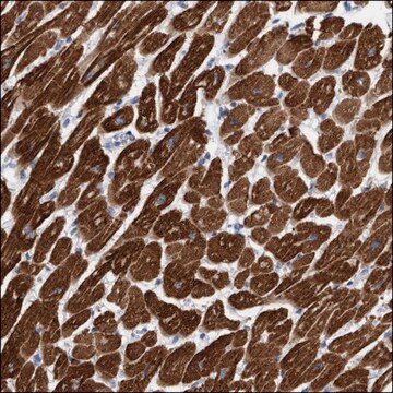 Anti-KRIT1 antibody produced in rabbit Prestige Antibodies&#174; Powered by Atlas Antibodies, affinity isolated antibody, buffered aqueous glycerol solution