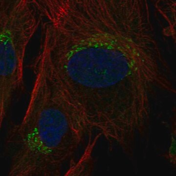 Anti-Tnfrsf11B Antibody Produced In Rabbit Prestige Antibodies&#174; Powered by Atlas Antibodies, affinity isolated antibody, buffered aqueous glycerol solution