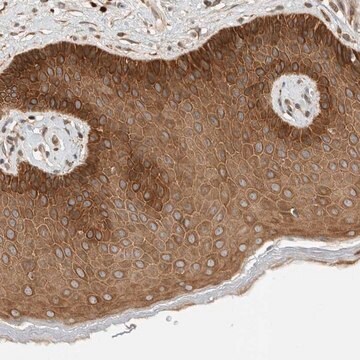 Anti-ARMC9 antibody produced in rabbit Prestige Antibodies&#174; Powered by Atlas Antibodies, affinity isolated antibody, buffered aqueous glycerol solution