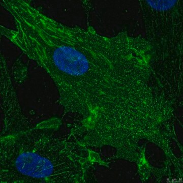 Przeciwciało anty-Integryna alfa 5 (CD49e), klon mAb11 clone mAB11, from rat