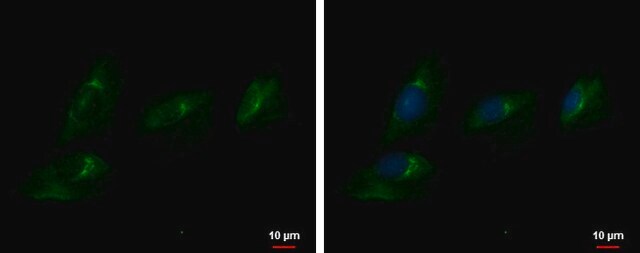 抗-ENPP2 兔抗 affinity isolated antibody, buffered aqueous solution