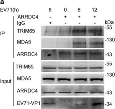 Anti-TRIM65 antibody produced in rabbit Prestige Antibodies&#174; Powered by Atlas Antibodies, affinity isolated antibody, buffered aqueous glycerol solution, Ab2